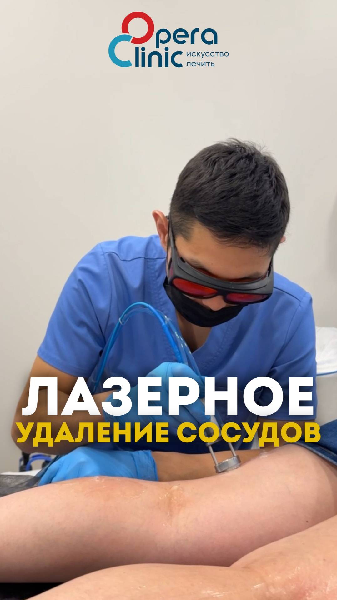 Лазерное удаление сосудов