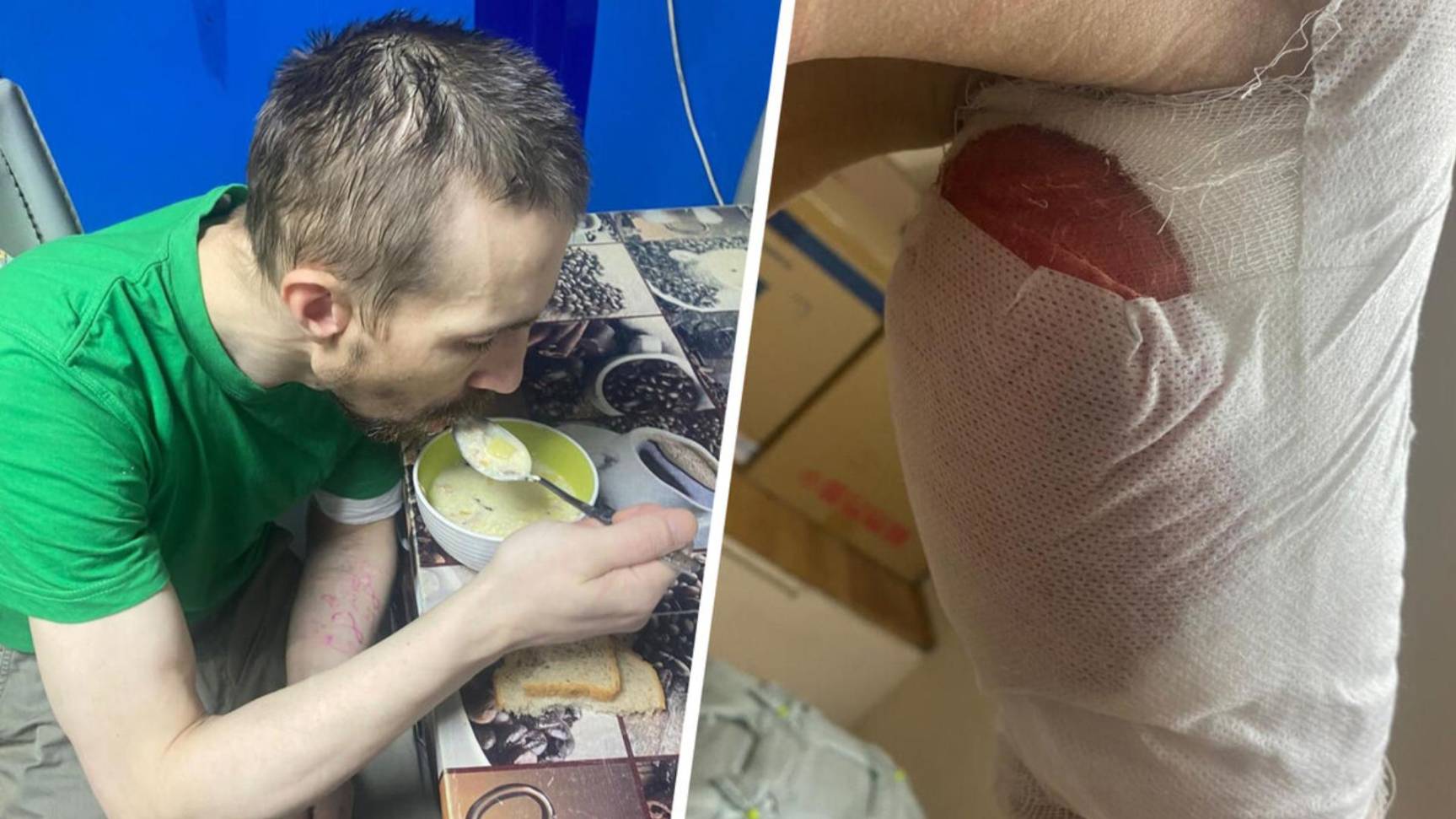 Ветеран СВО с гноящимися ранами оказался в социальном приюте