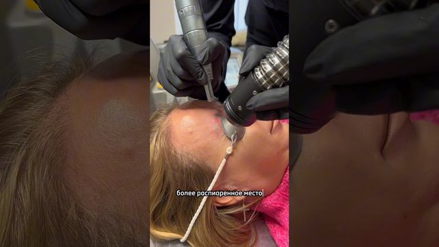 Где удалить тату?