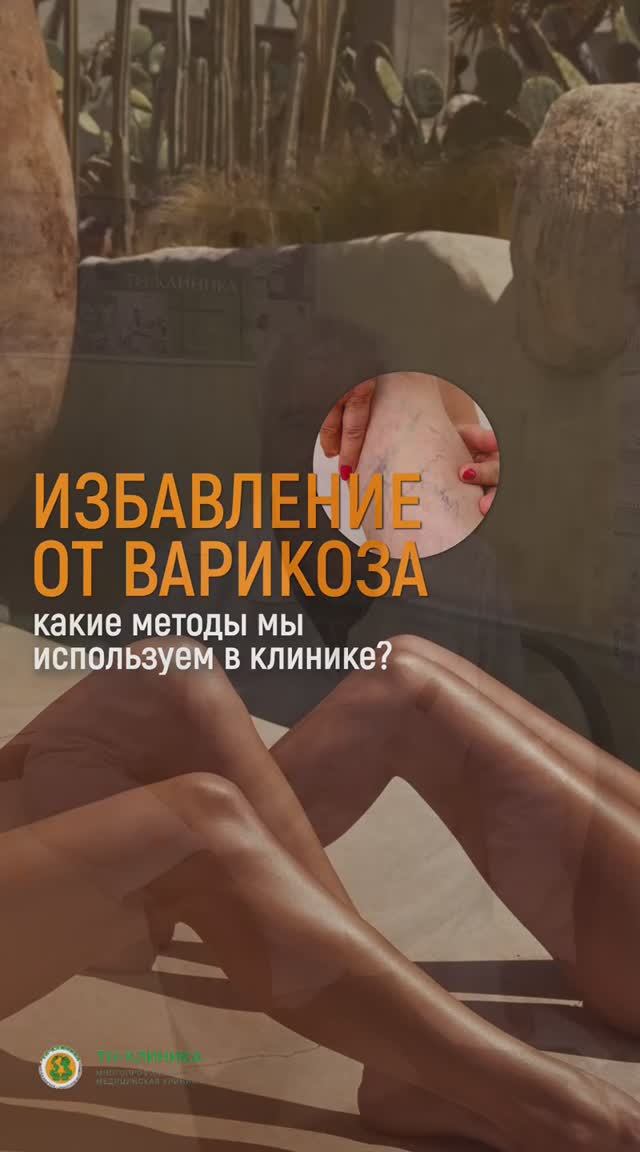 Избавление от варикоза. Какие методы мы используем в клинике?