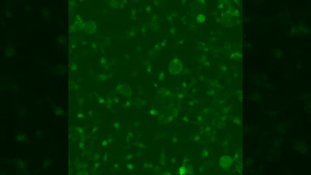 Neuroni e cellule di Schwann