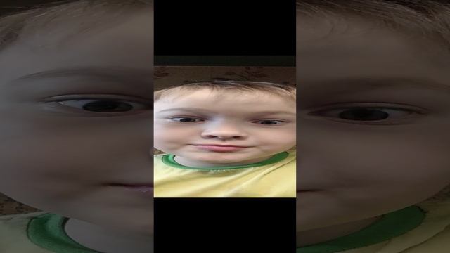 Я умею выделять кровь из зо рта🩸