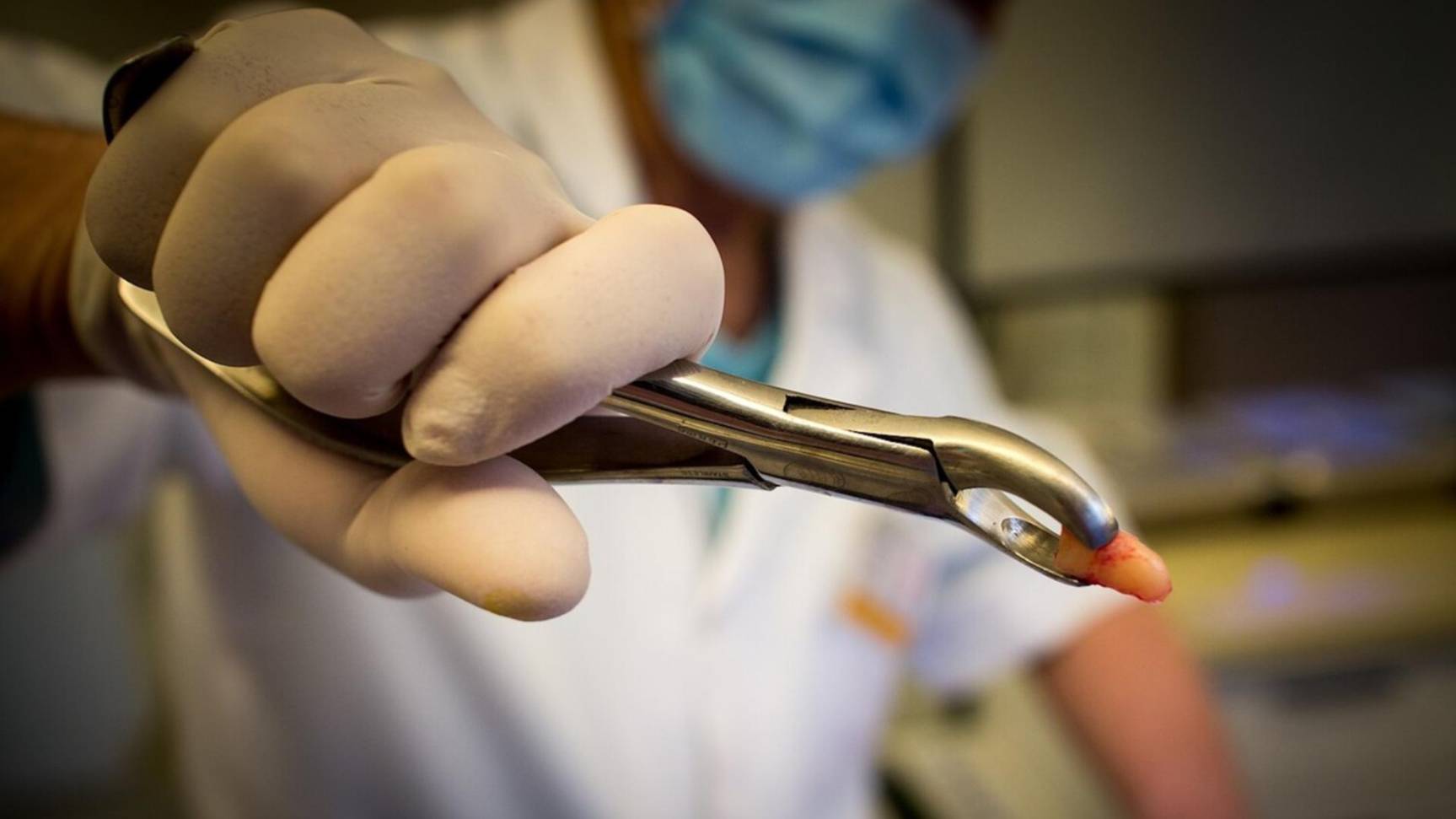 Пациент обвинил удалившего ему 18 здоровых зубов стоматолога в наживе