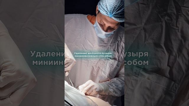 Удаление желчного пузыря. Показали как выглядят камни. Холецистэктомия  #врач  #владимир #москва