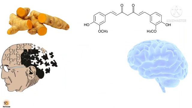 Vestige Curcumin Plus | Health Benefits In Hindi | Acharya Vineeta Maurya