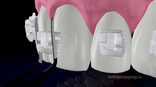 QuicKlear c керамической крышкой