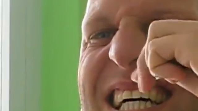 Минивинты OrthoEasy др. Björn Ludwig