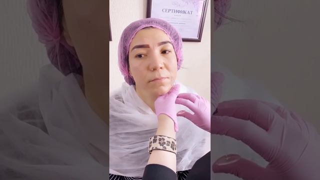 АЖИН ЁЗИШ МУОЛАЖАСИ | AJIN YOZISH MUOLAJASI | КОСМЕТОЛОГ МАФТУНА ИБРАГИМОВНА ОШ