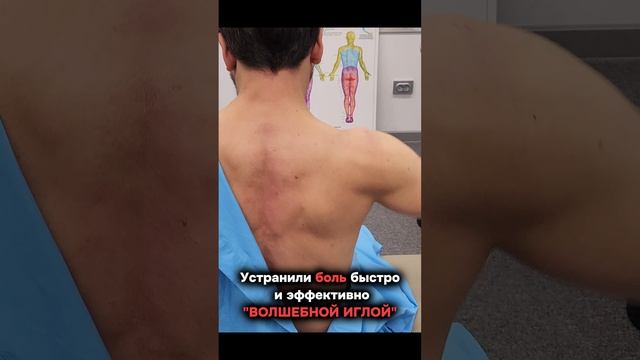 БЫСТРО И ЭФФЕКТИВНО УСТРАНЯЕМ БОЛЬ!