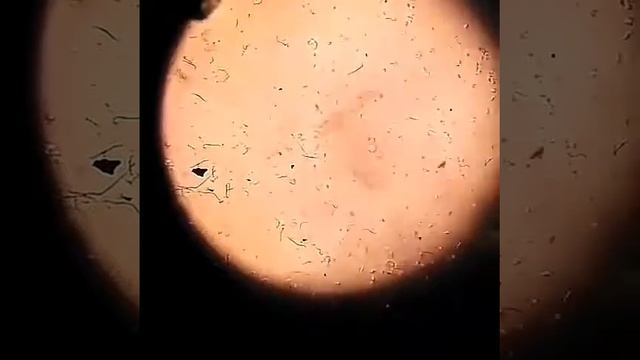 Sperma, human spermatogenesis under microscope