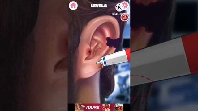 ear infections treatment  # by bareera  asmr