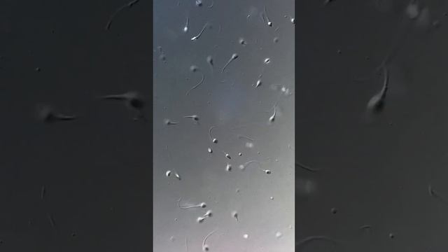 A análise microscópica de espermatozoides células reprodutiva masculina