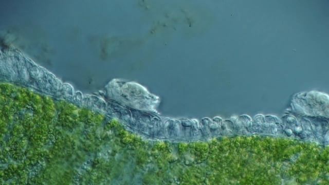 Hamburger Polypenlaus - Trichodina pediculus - unter dem Mikroskop