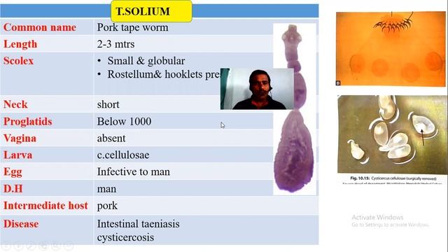 Differences between T.solium & sagunata