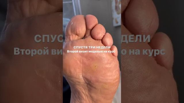 К чему может привести самолечение