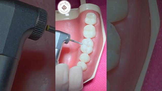 Aula partica de Acabamento e Polimento em Resina Composta de dentes posteriores