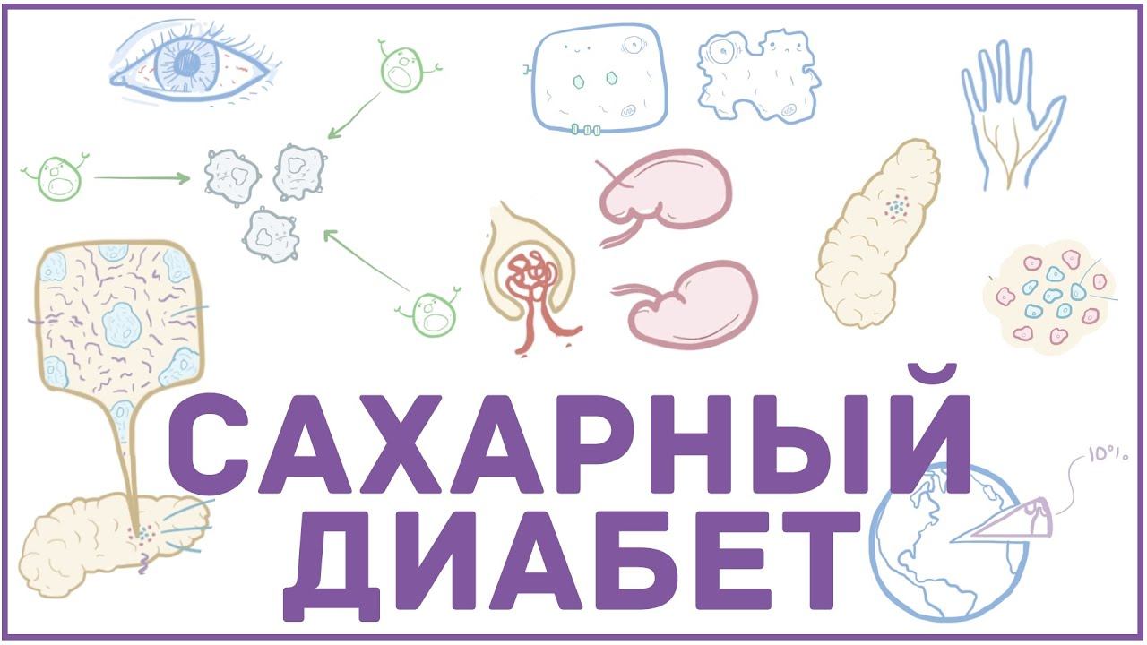 Сахарный диабет - 1 и 2 тип, причины, симптомы, кетоацидоз, гиперосмолярная гипергликемия