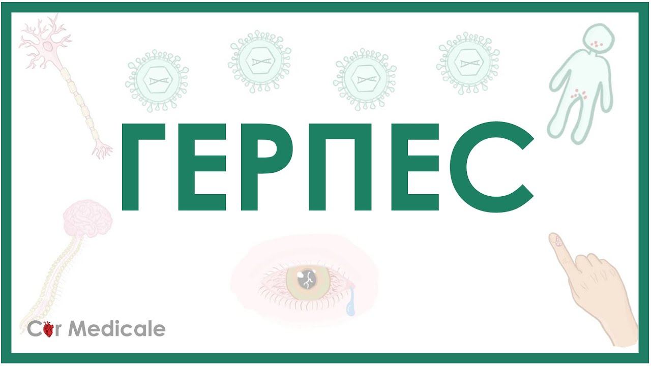 Герпес - причины, симптомы, диагностика