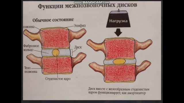 2)Осхеохондроз простым языком.