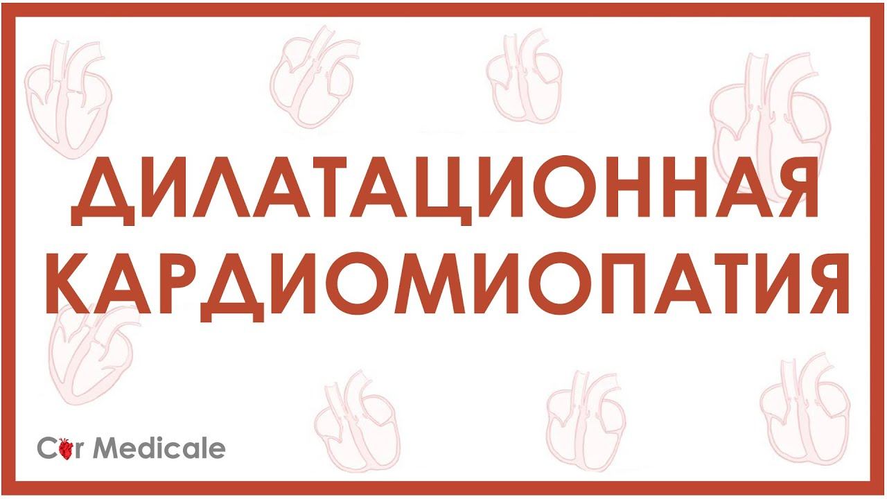 Дилатационная кардиомиопатия - причины, механизмы, симптомы, последствия