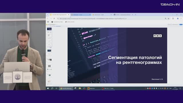 Артем Васильев. Тема: Сегментация патологий на рентгенограммах