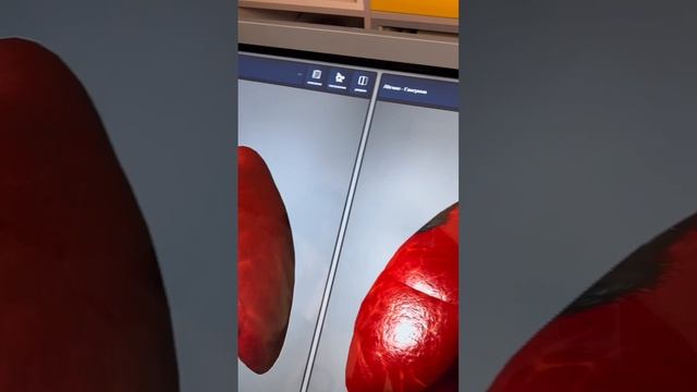Медицинский атлас