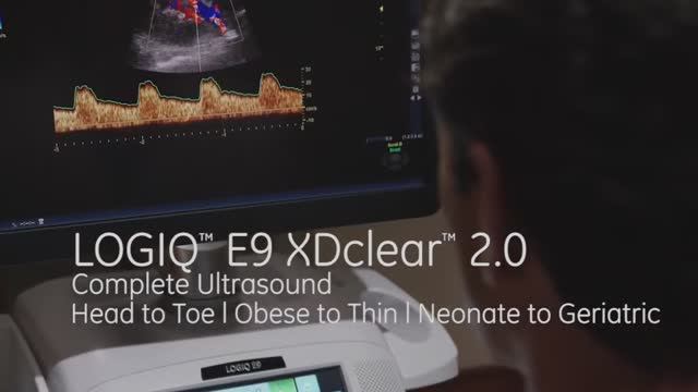 LOGIQ E9 XDclear