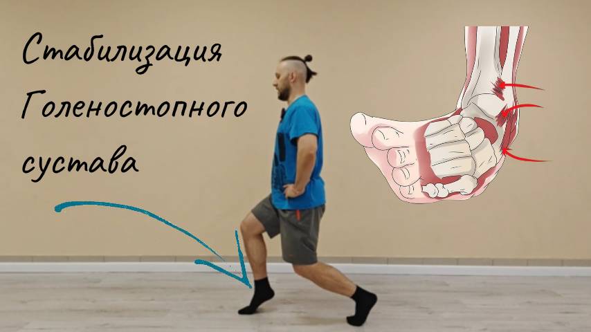 Стабилизация ГС. Что делать при хронической нестабильности?