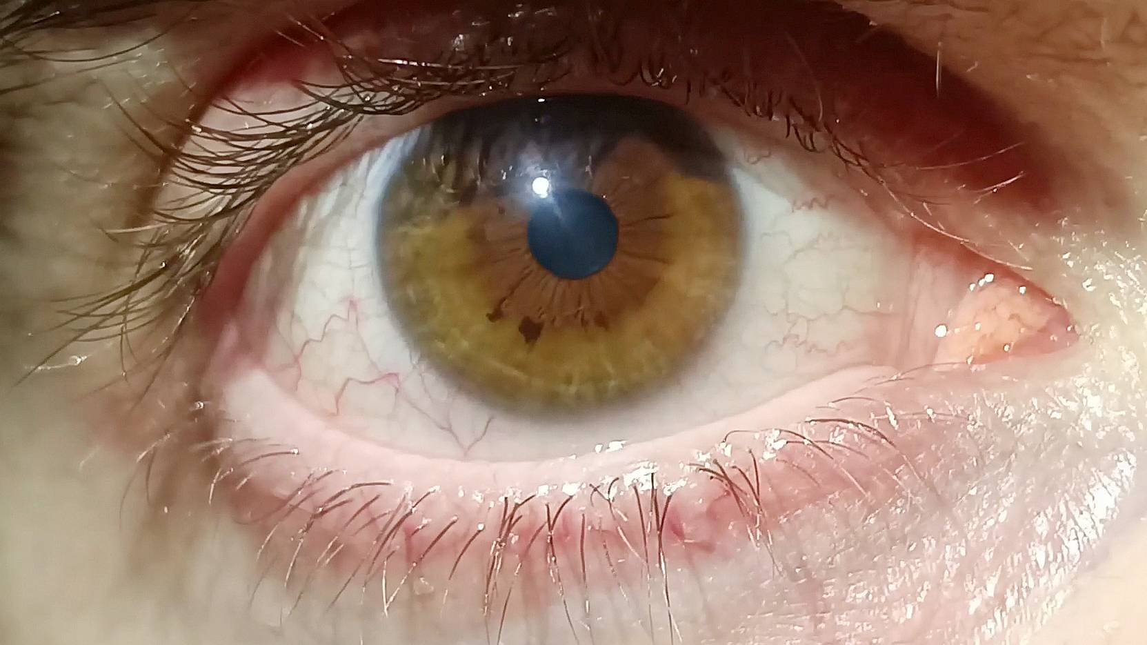 EYEORIGINS