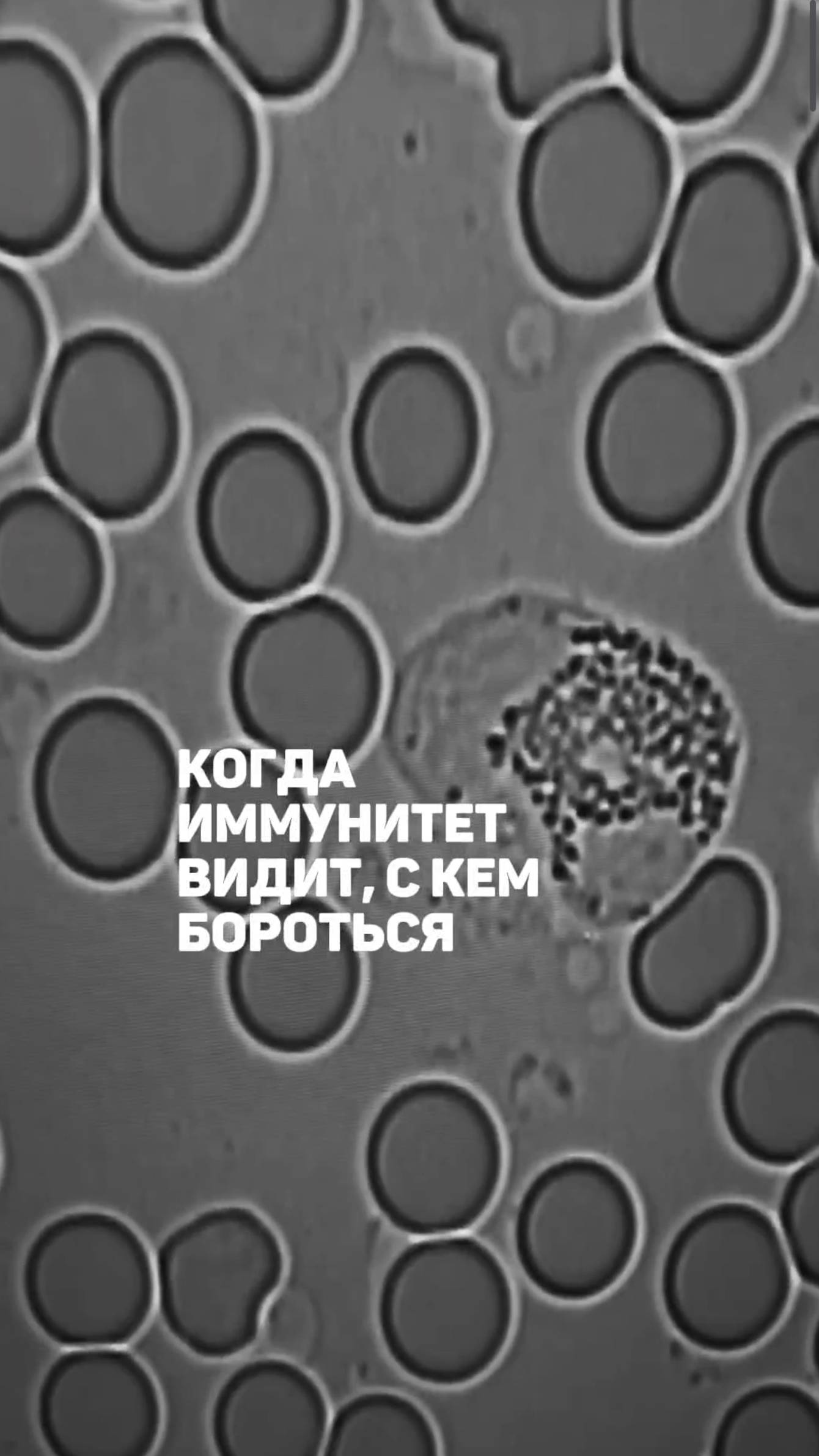 Когда иммунитет видит, с кем бороться