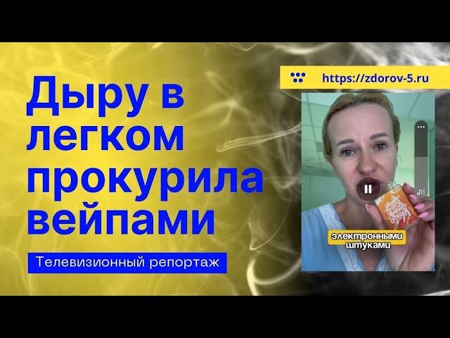 ВЕЙП и дыра в легком. Дыру в легом жительница Сочи прокурила вейпом