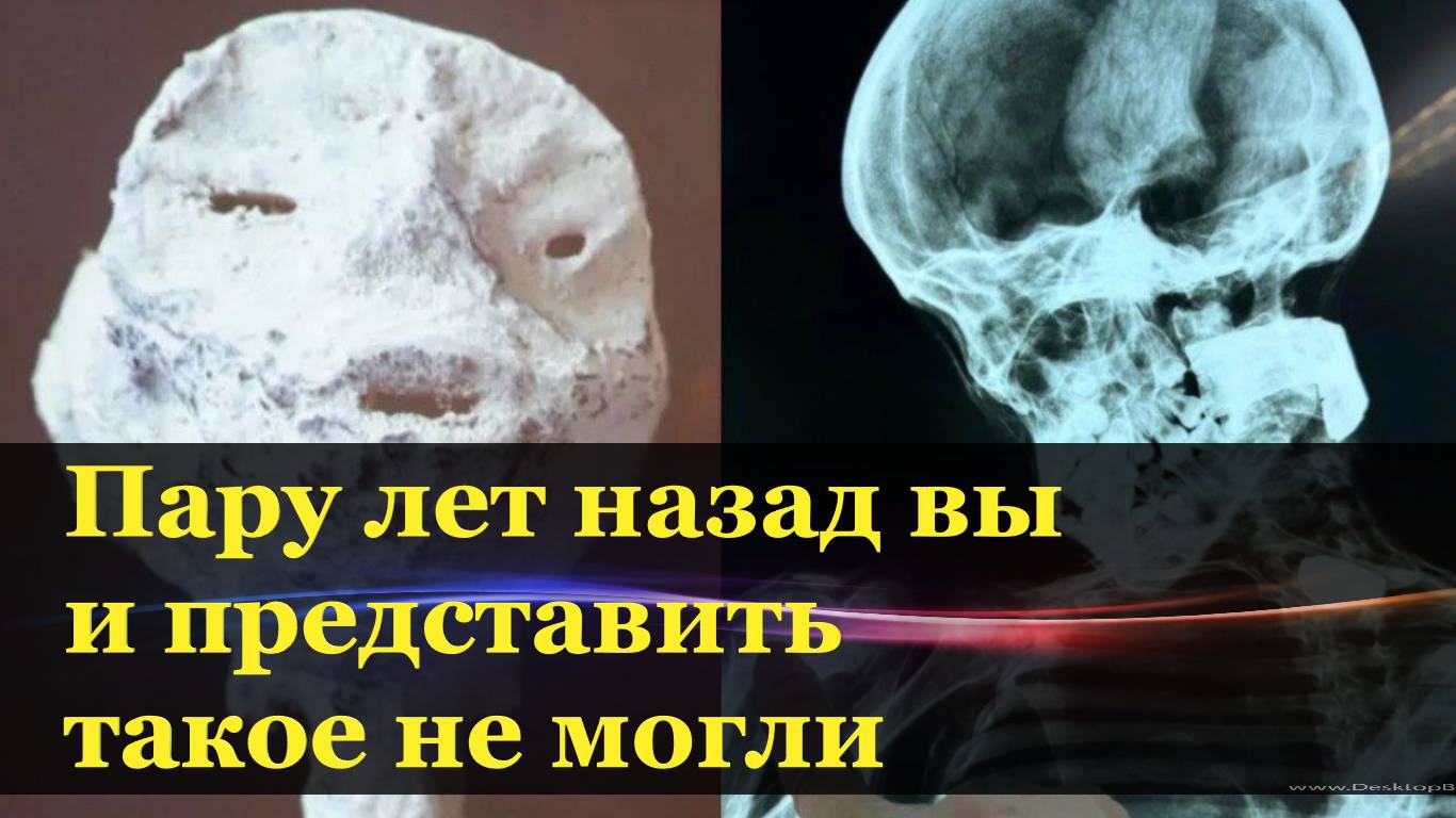 В Перу обнаружена новая, уже седьмая «инопланетная мумия». Объявлено международное расследование.