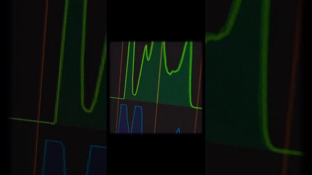 Bjork x Kinash - All Is Full Of Love (demo cut)