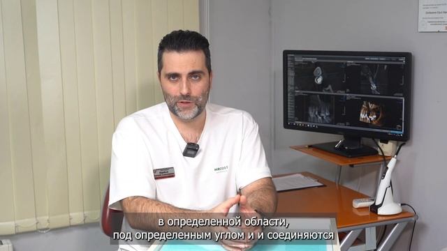 Протезирование на имплантатах All-on-4