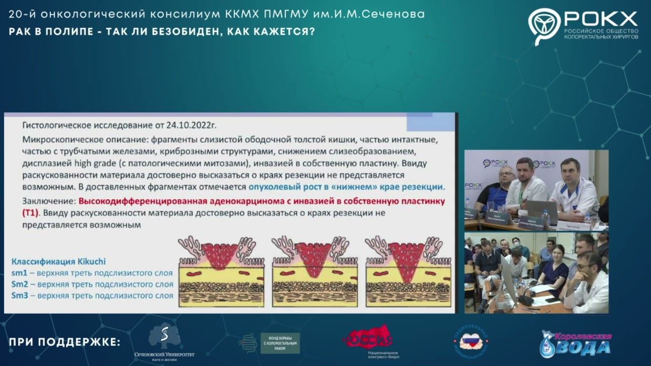 Тулина Инна Андреевна -  Значение диалога хирурга и морфолога