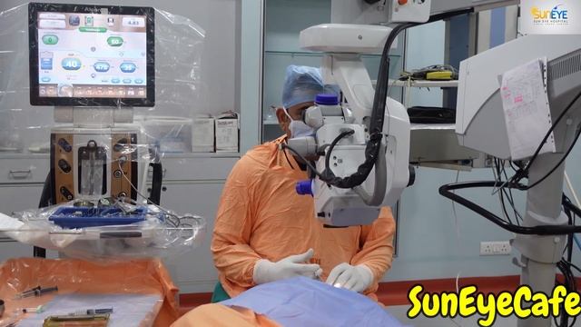 CLEAR LENS EXTRACTION I CLE eye surgery for high numbers I CLE for specs removal #suneyecafe
