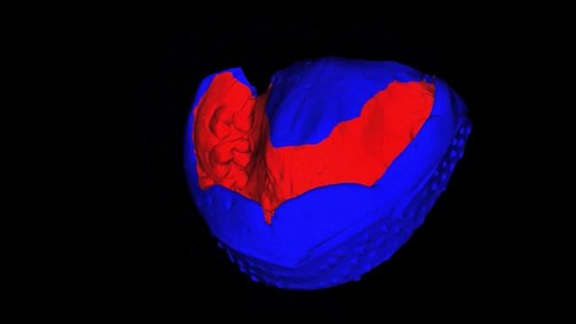 Genoray Papaya 3D 23x24 - интеллектуальная система позиционирования