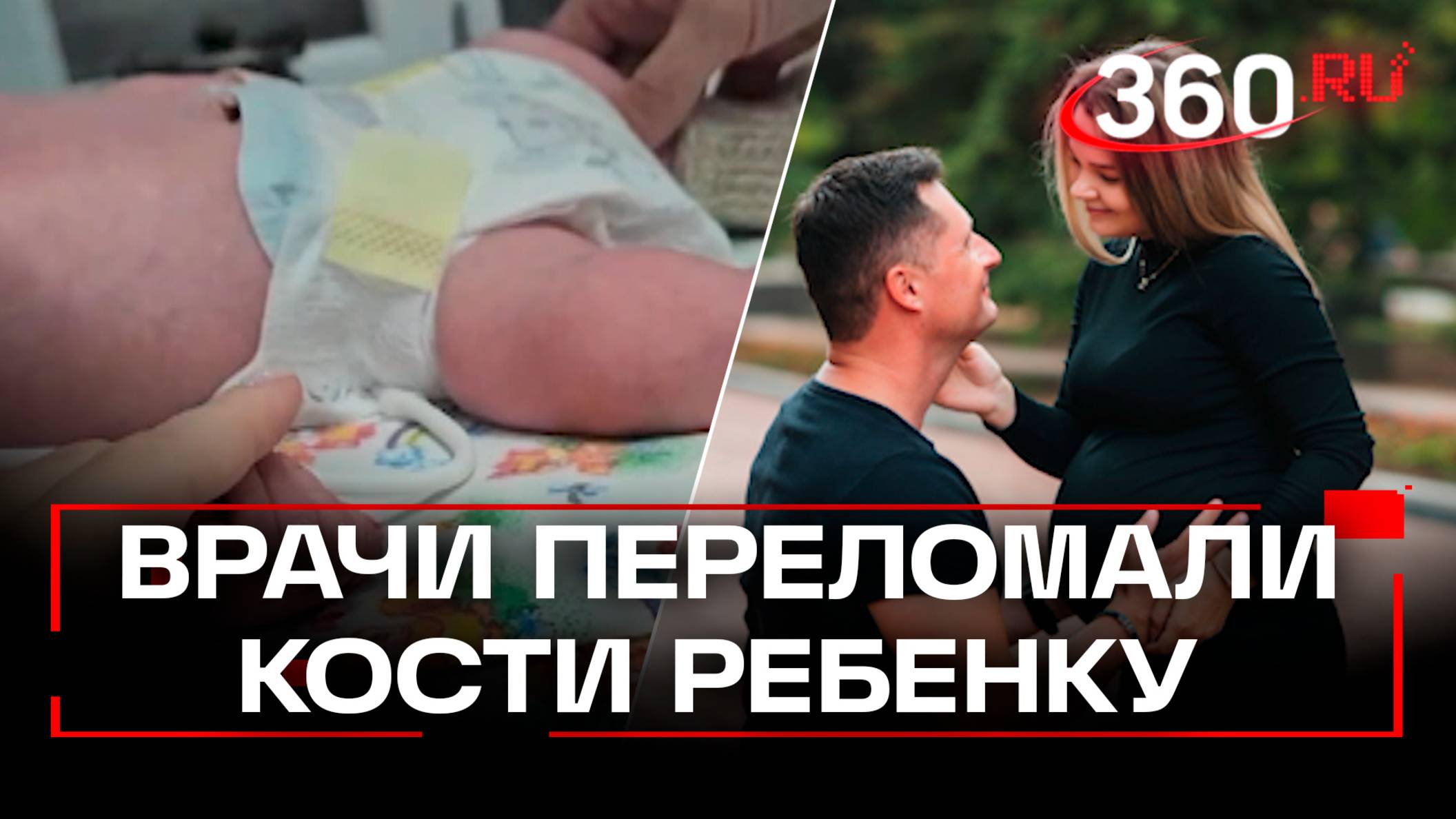 Выдавливали ребенка локтями и сломали ему кости во время родов - мать требует компенсацию от врачей