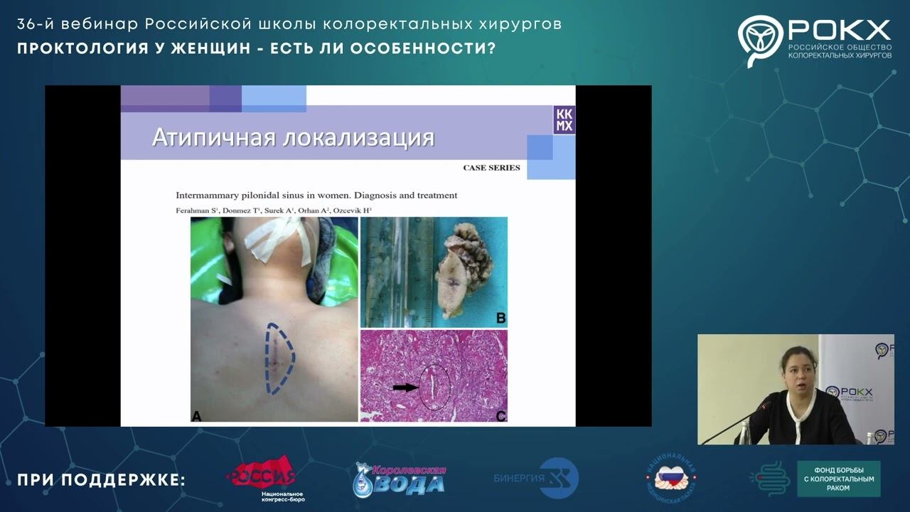 Шлык Дарья Дмитриевна   Этиология и особенности лечения пилонидальных кист у женщин