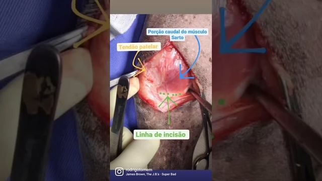 Cirurgia TPLO: ruptura de ligamento cruzado cranial em cães #animaisdeestimação #clinicaveterinaria