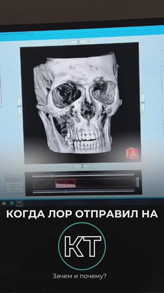 Зачем нужна КТ при проблемах с носом? История нашего пациента Кирилла 📖