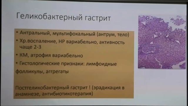 2024 06 22 Гастро07 Крайнова ЕА Морфологические классификации Гастрита