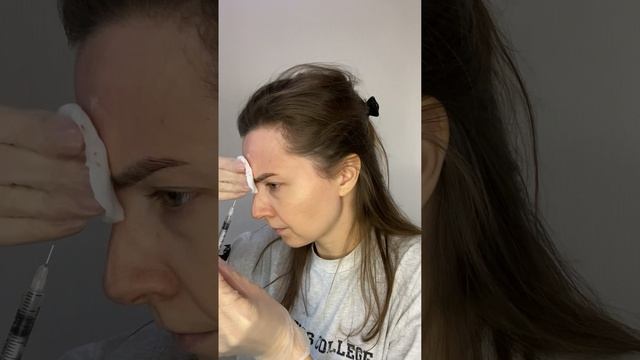 Сделала ботокс самой себе!