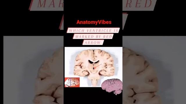 Coronal Sections of Brain | Third Ventricle | Anatomy | Brain #anatomy #brain #neuroscience #neuro