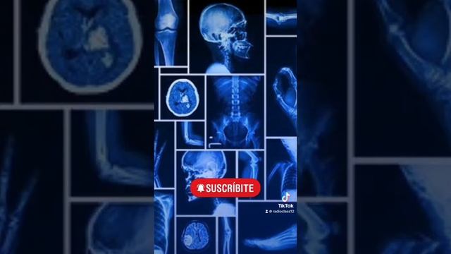 Funciones del sistema esqueletico 🩻🦴 #radiologiaeimagenologia☢️❤#anatomia #sistemaesqueletico