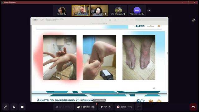 за 30 лет детская онкология, впервые выявленная, выросла в 4.72 раза