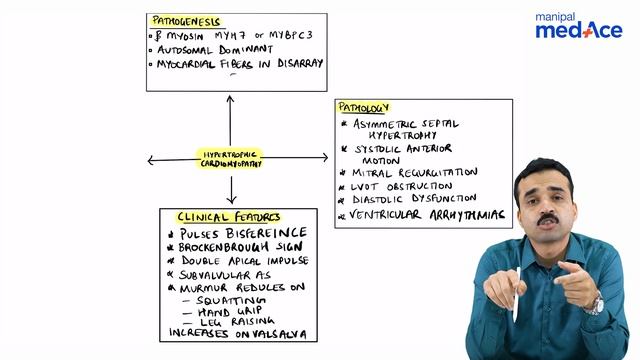 General Medicine - Hypertrophic Cardiomyopathy