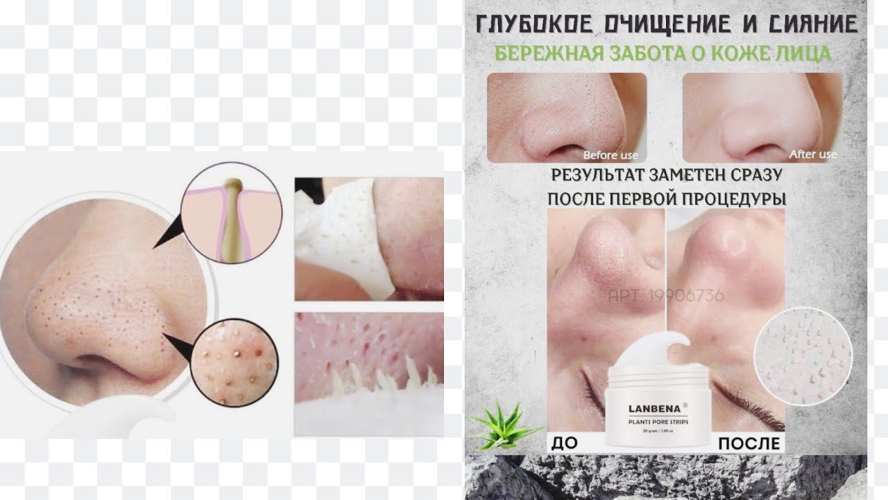 Супер удаление чёрных точек #как убрать черные точки#красота