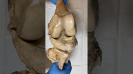 Knee Joint #humanbody #anatomy #medical #neetaspirants #jointpain #bones