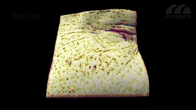 Antera 3D – аппарат для визуализации и диагностики в косметологии